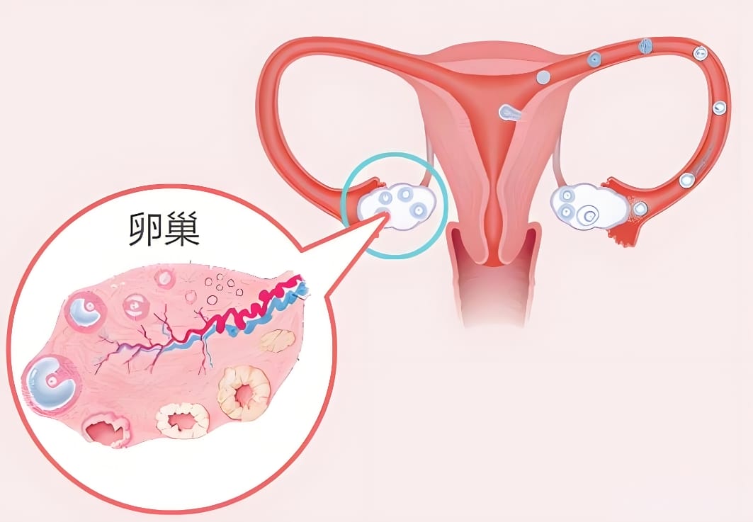 AMH0.01等于卵巢里一颗卵子都没有了？