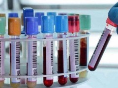 孕酮标准对照表 血hcg和孕酮正常参考图