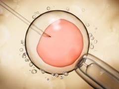 20岁都能卵巢综合症是怎么回事？会有哪些表现？