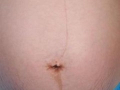 怀孕期间肌肤干燥怎么办_孕妇皮肤干如何护肤